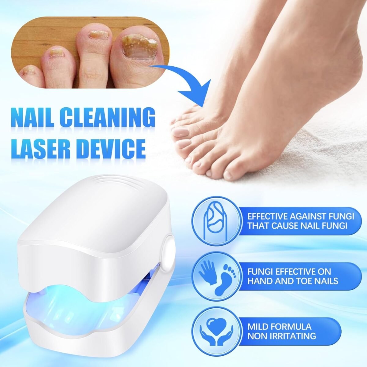 Rechargeable Nail Fungus Laser – Anti-Fungal Device for Toenails, Hands & Feet (Home Use) - Image 3