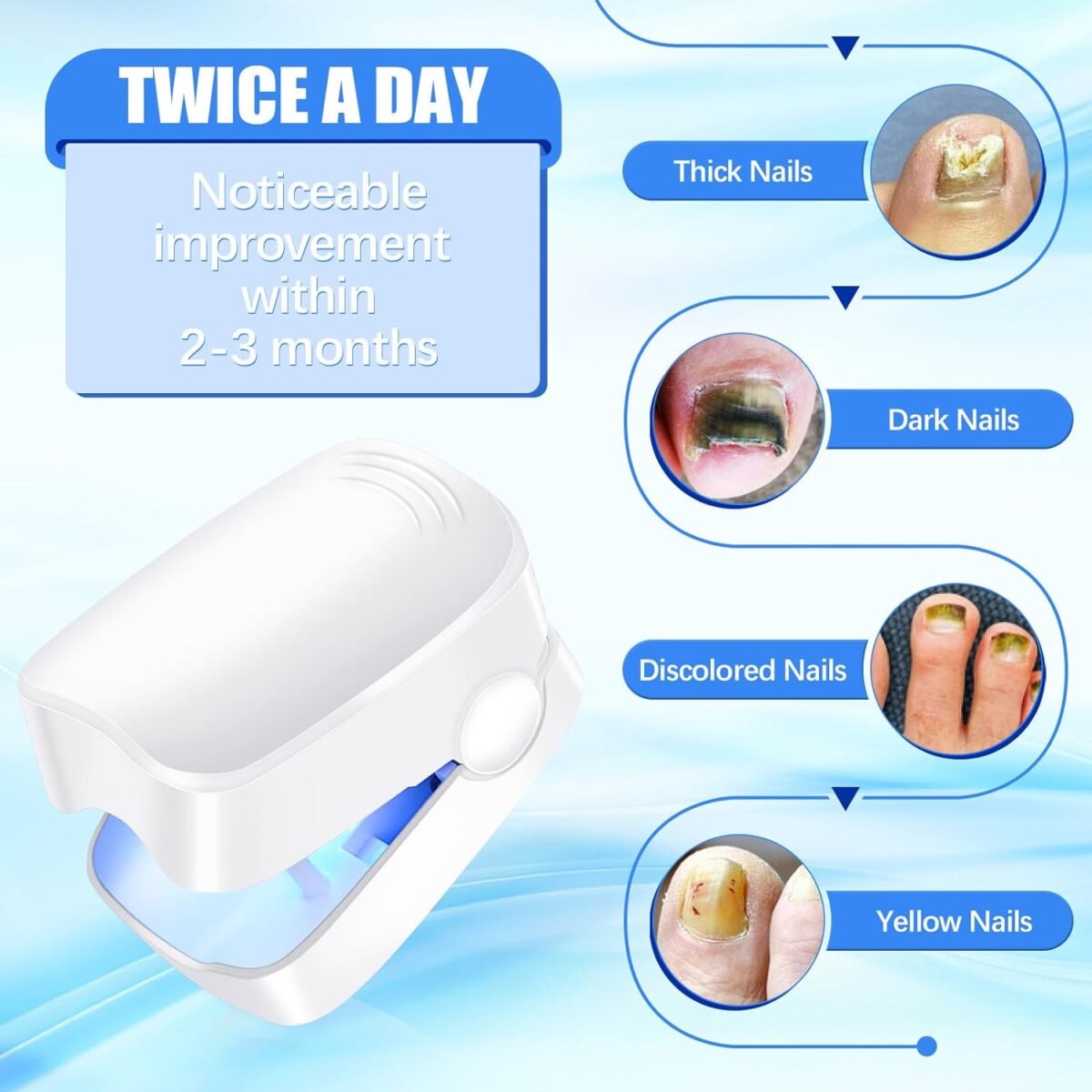 Rechargeable Nail Fungus Laser – Anti-Fungal Device for Toenails, Hands & Feet (Home Use) - Image 7