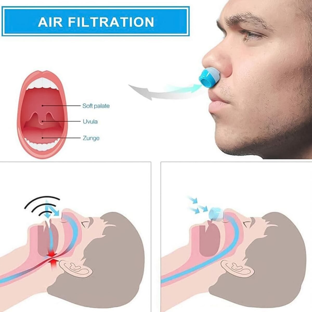 2 in 1 Anti Snoring and Air Purifier Nose Clip Anti Snoring Device (1 Pc / With Plastic Case) - Image 4