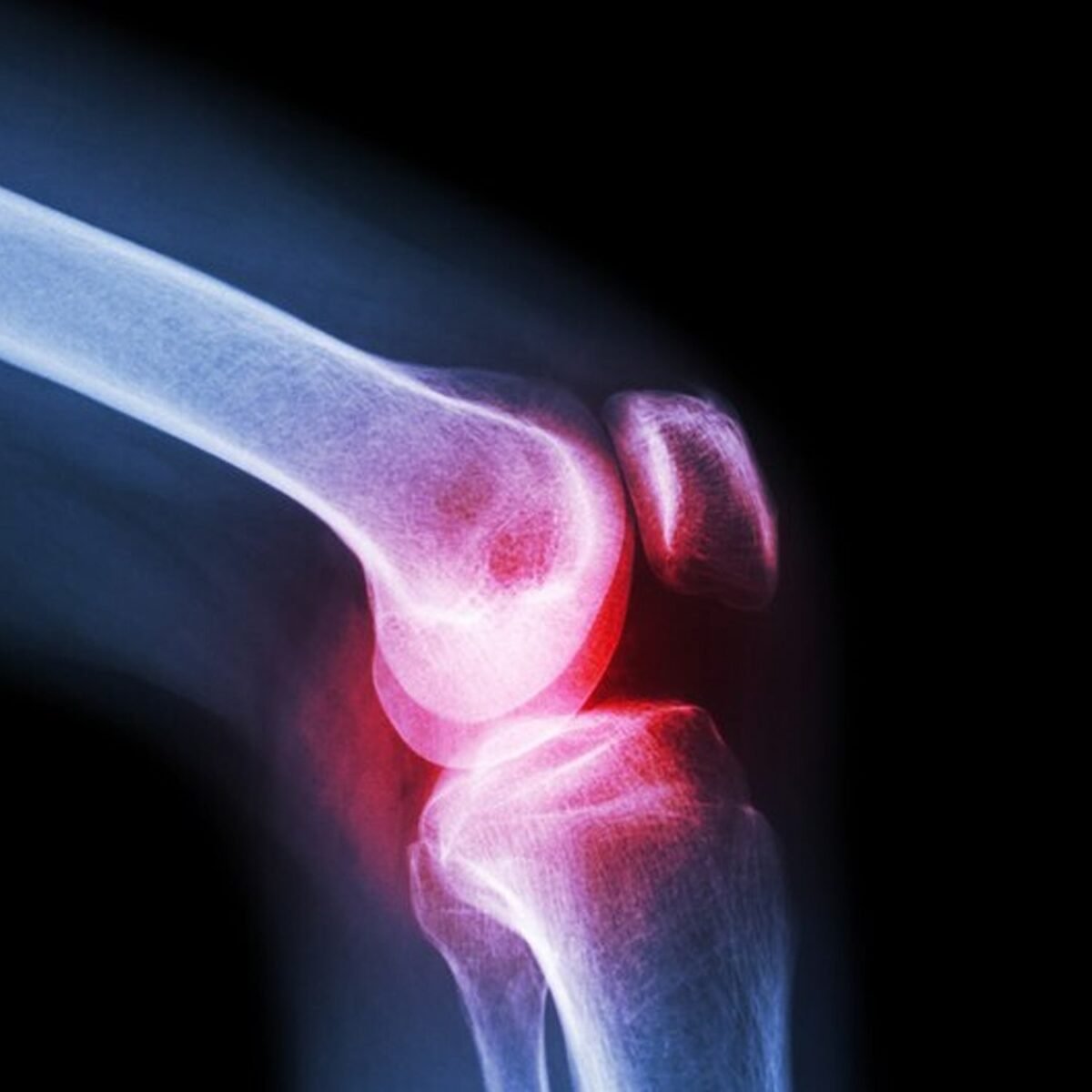 Knee Cap for Knee Support (Large) - Image 7