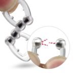 Anti-Snore Nose Clip for Heavy Snorers (Silicone, 1 Pc) - Image 8